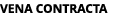 VENA CONTRACTA